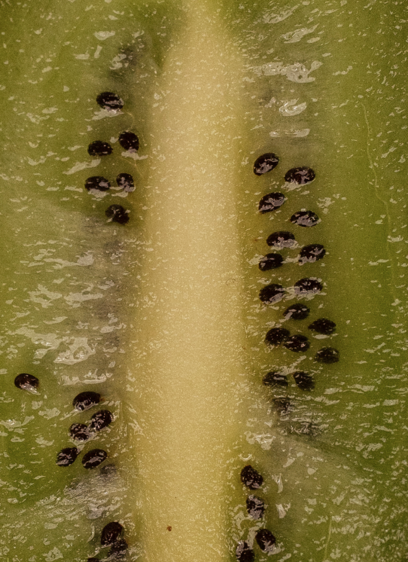 The Surprising Connection Between PCOS and ADHD: What You Need to Know