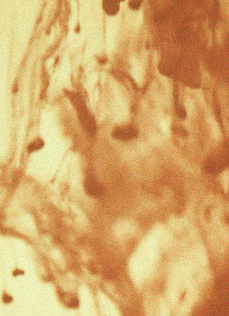 The Endometriosis Diet: What To Eat For Hormonal Balance